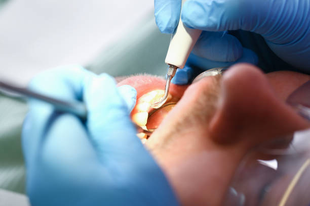 Best Emergency Tooth Extraction  in Ossian, IN