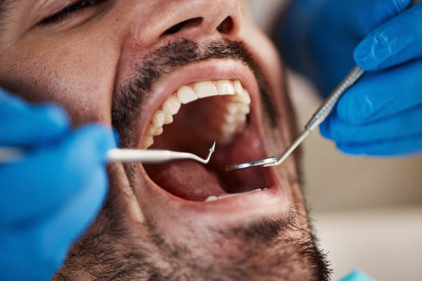 Best Urgent Tooth Repair  in Ossian, IN